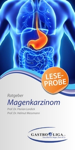 Ratgeber Magenkarzinom