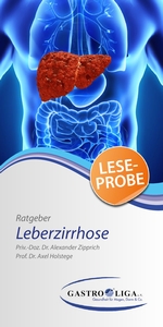 Ratgeber Leberzirrhose 